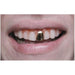 Scarecrow Gold Cap Costume Teeth