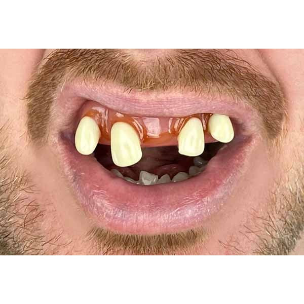 Billy Bob Tiger Novelty Teeth