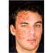 Infected Halloween Masquerade Costume Item