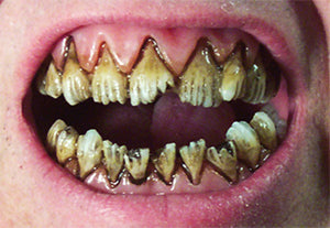 Dental Distortions Kreeper FX Fangs Costume Teeth Kit