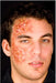 Infected Halloween Masquerade Costume Item